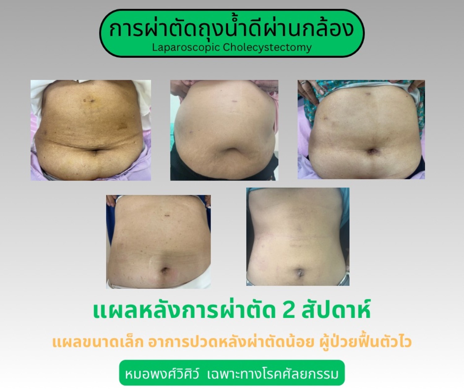 ภาพประกอบ 10