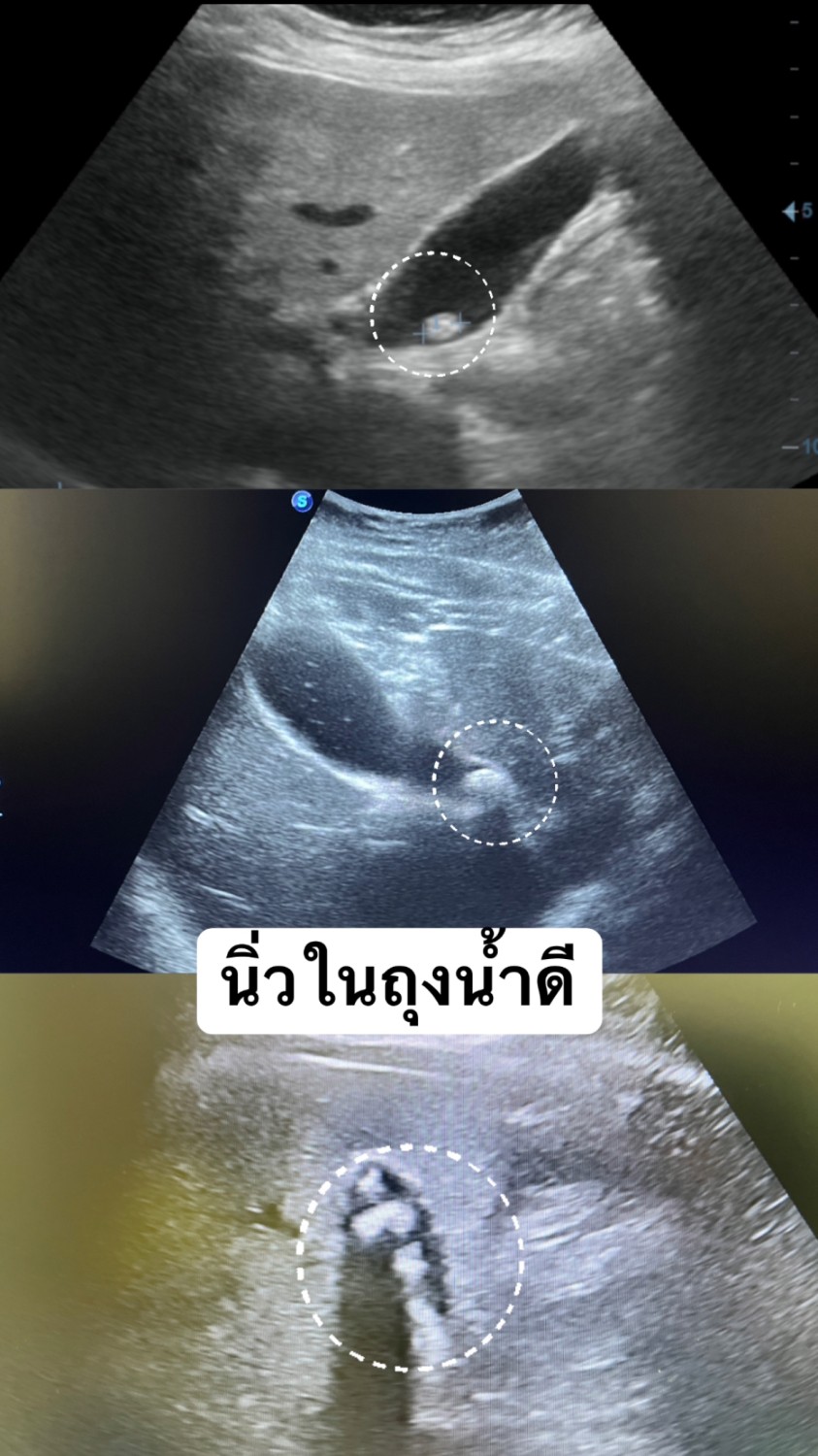 ภาพประกอบ 1
