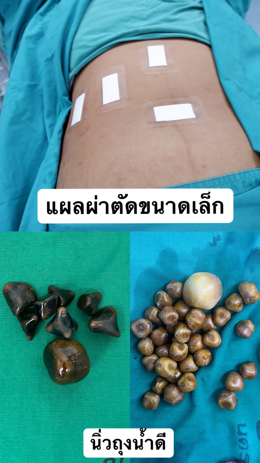 ภาพประกอบ 3