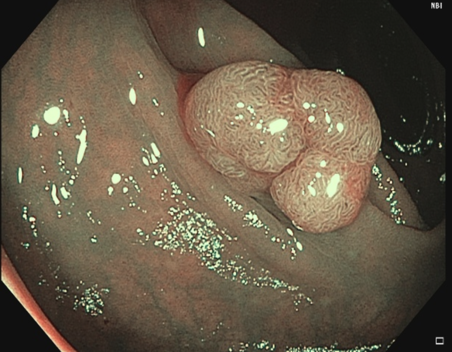 ภาพประกอบ 6