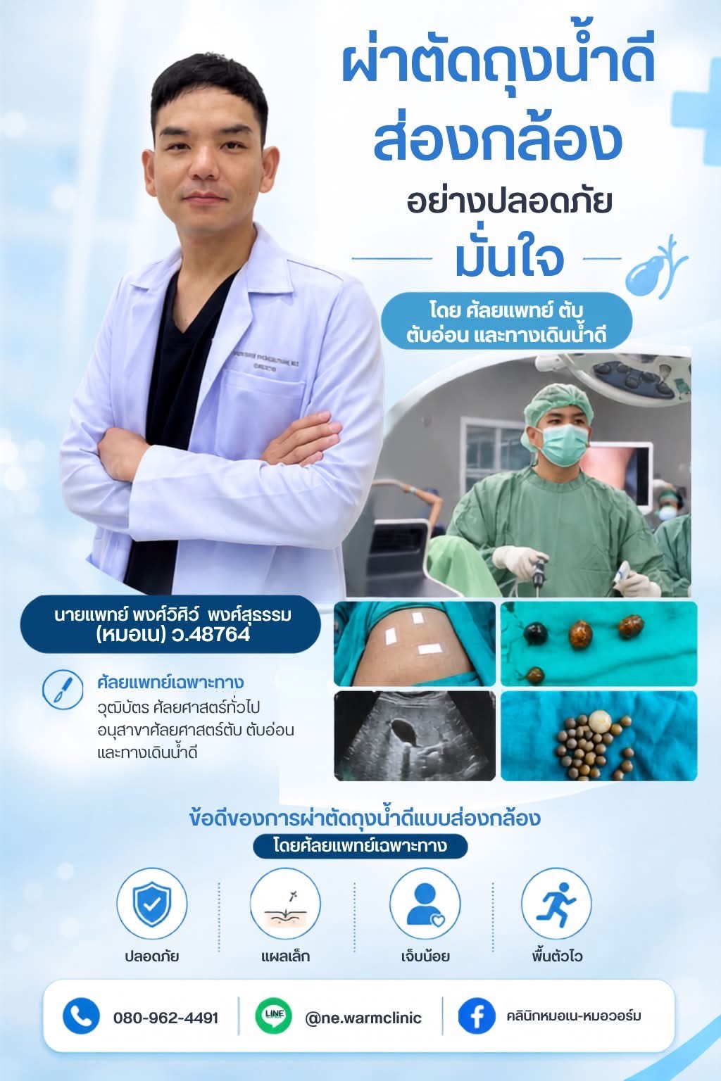 ผ่าตัดถุงน้ำดีส่องกล้อง